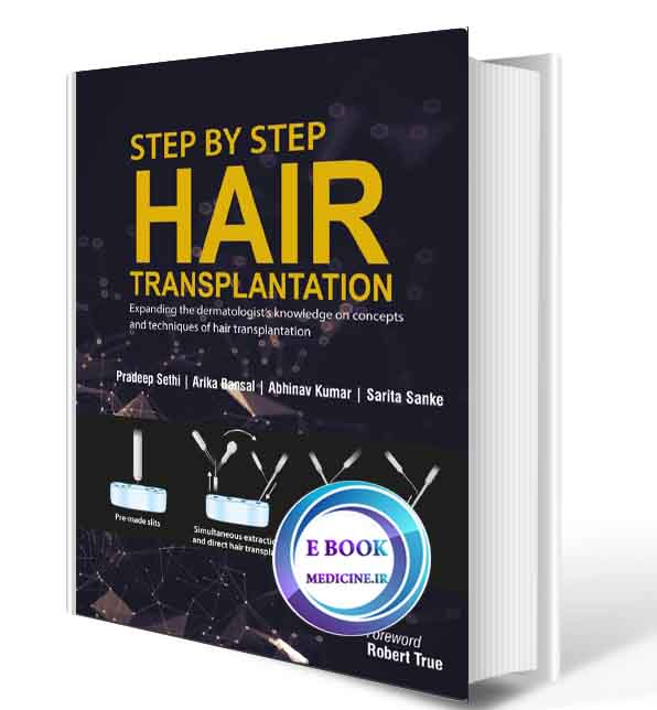 دانلود کتابStep by Step Hair Transplantation2019(ORIGINAL PDF)